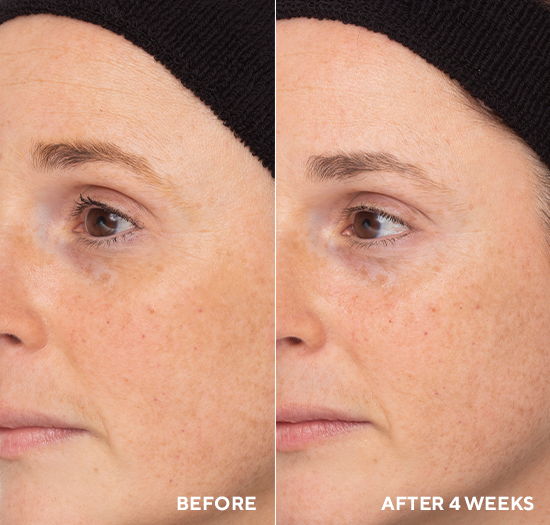 Retinol Routine Booster - Image 3